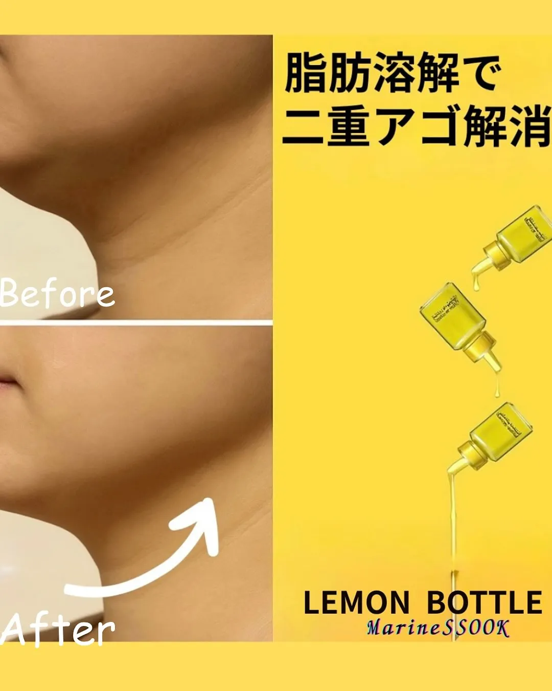 🍋レモンボトル脂肪溶解🍋